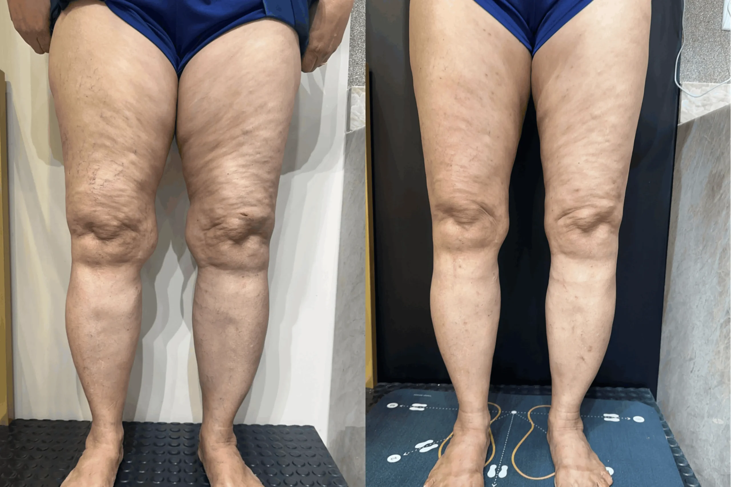 LEG SLIM - Oficial-1 1