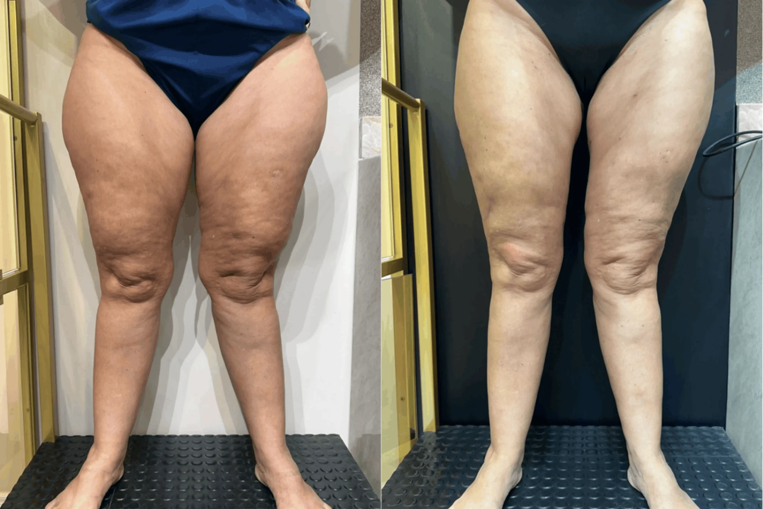 LEG SLIM - Oficial (2)-1 1