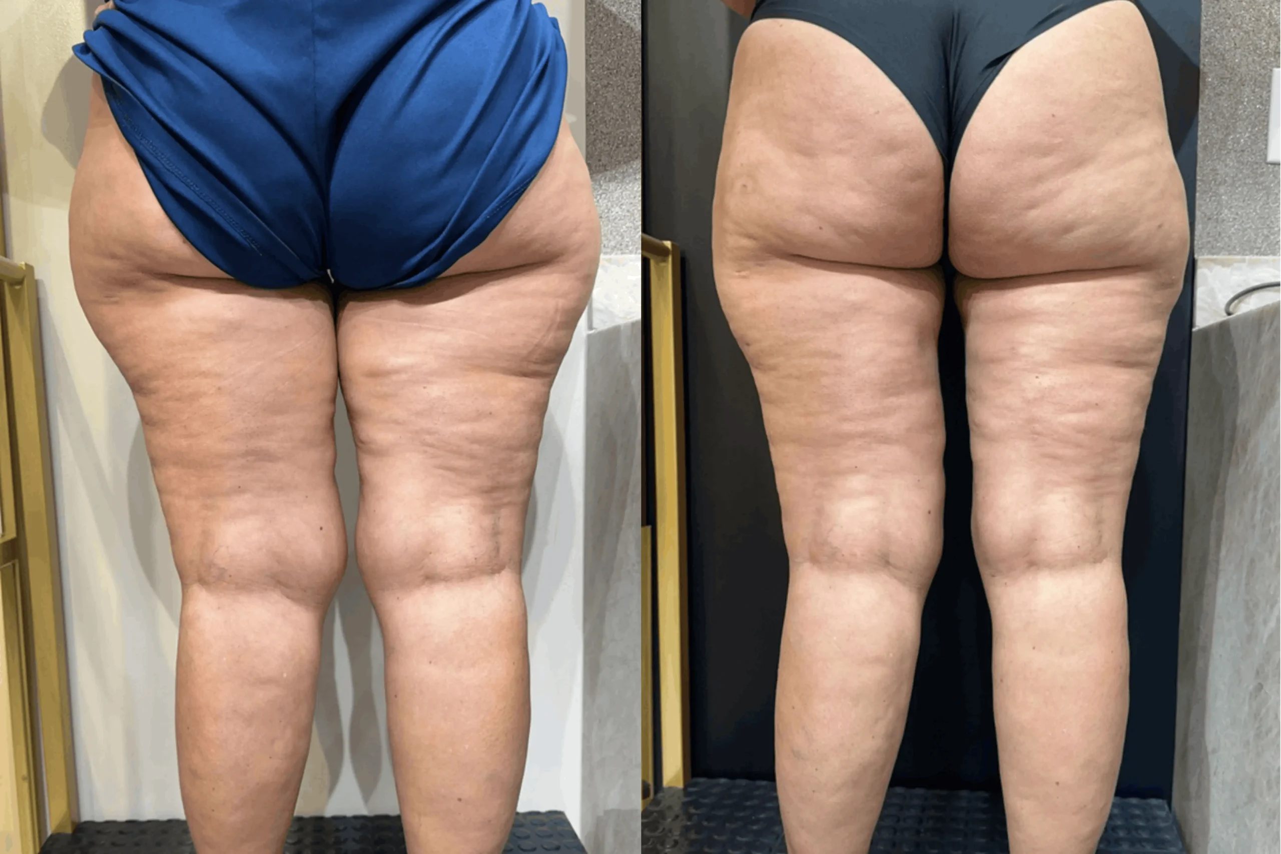 LEG SLIM - Oficial (4)-1 1
