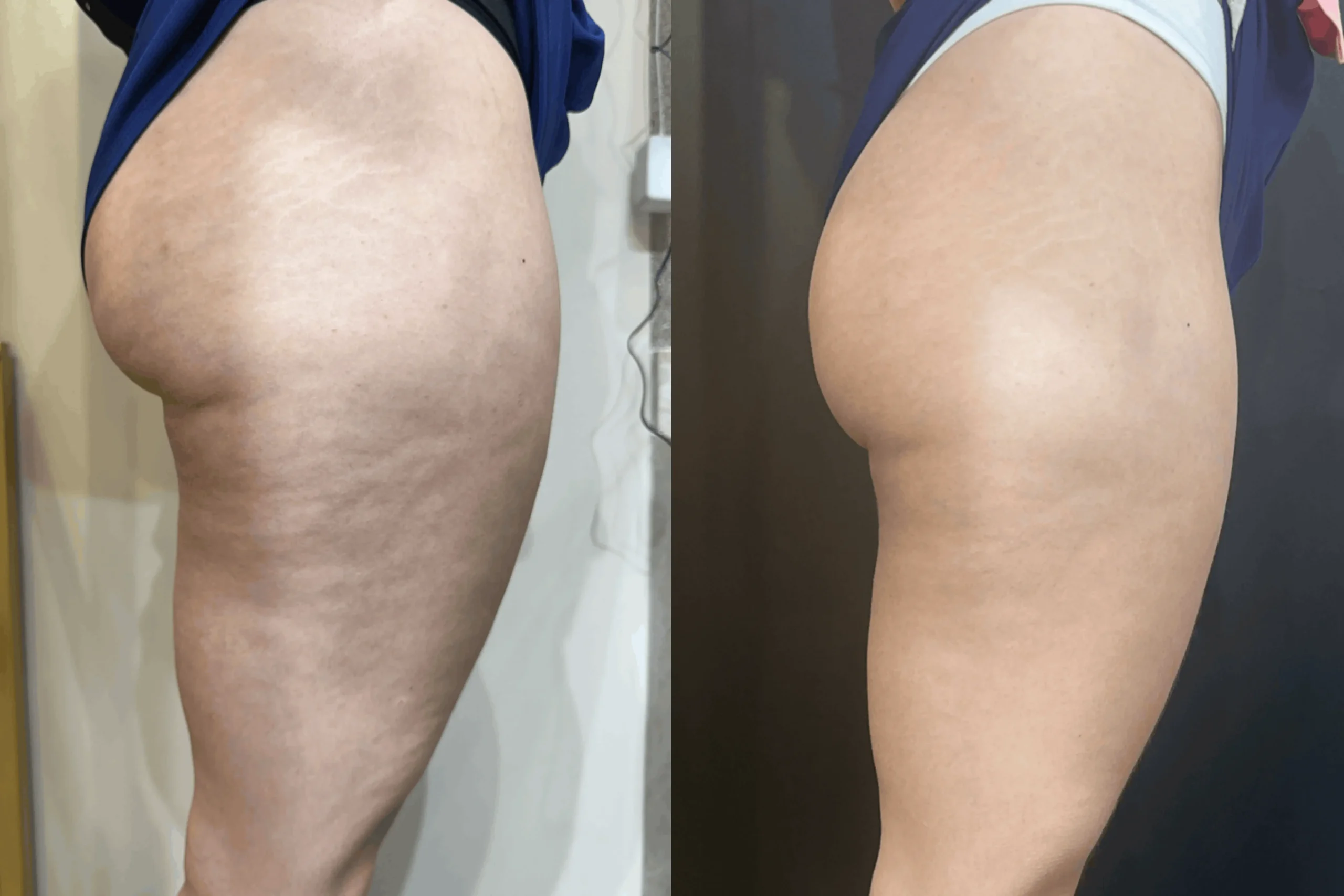 LEG SLIM - Oficial (5)-1 1