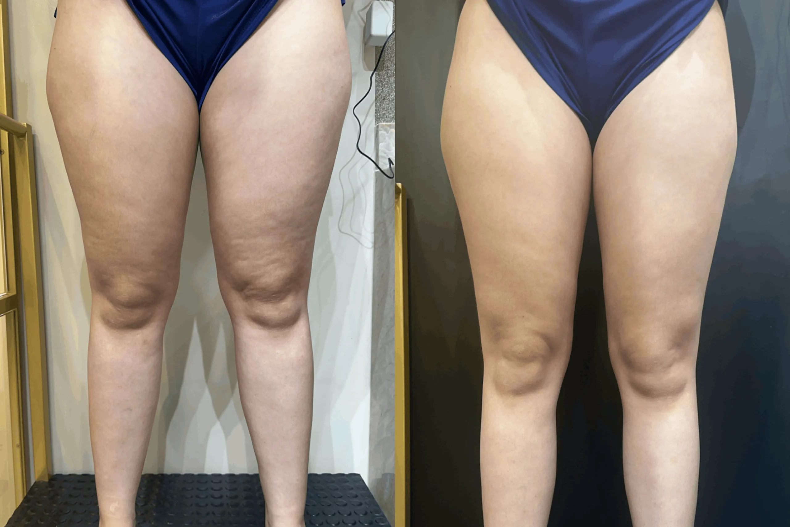 LEG SLIM - Oficial (6)-1 1